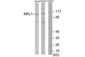 Western blot analysis of extracts from HeLa cells and HUVEC cells, using MKL1 antibody. (MKL1 Antikörper  (N-Term))