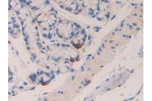 Immunohistochemistry (IHC) image for anti-Chemokine (C-C Motif) Ligand 4 (CCL4) (AA 24-92) antibody (ABIN7430945)