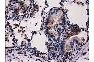 Image no. 5 for anti-Family with Sequence Similarity 127, Member C (FAM127C) antibody (ABIN1498197) (FAM127C Antikörper)