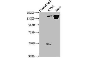 Immunoprecipitating KTN1 in A549 whole cell lysate Lane 1: Rabbit control IgG instead of ABIN7157562 in A549 whole cell lysate. (KTN1 Antikörper  (AA 978-1116))