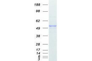 Validation with Western Blot