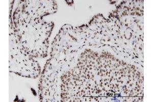 Immunoperoxidase of monoclonal antibody to RIOK2 on formalin-fixed paraffin-embedded human placenta. (RIOK2 Antikörper  (AA 453-551))