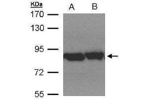 WB Image Sample(30 μg of whole cell lysate) A:Hep G2, B:MOLT4, 7. (TRAP1 Antikörper)