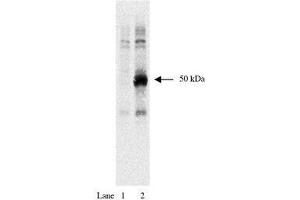 Image no. 1 for anti-HA-Tag antibody (ABIN793576) (HA-Tag Antikörper)