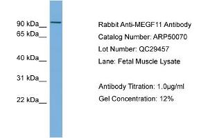 WB Suggested Anti-MEGF11  Antibody Titration: 0.