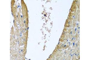 Immunohistochemistry of paraffin-embedded Mouse heart using COX5B Polyclonal Antibody at dilution of 1:100 (40x lens). (COX5B Antikörper)