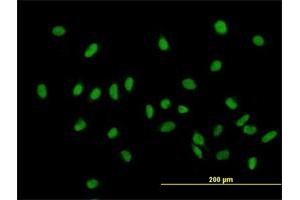 Immunofluorescence of purified MaxPab antibody to ZHX1 on HeLa cell. (ZHX1 Antikörper  (AA 1-873))