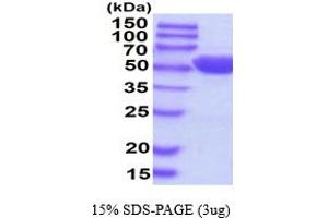 SDS-PAGE (SDS) image for Alanine Aminotransferase (ALT) (AA 1-496) (Active) protein (His tag) (ABIN7529284) (ALT Protein (AA 1-496) (His tag))