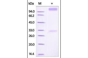 Human IFN-alpha/beta R1, Fc Tag on SDS-PAGE under reducing (R) condition. (IFNAR1 Protein (AA 28-436) (Fc Tag))