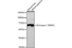 Western blot analysis of extracts of various cell lines, using Kininogen 1 (KNG1) antibody (ABIN3022363, ABIN3022364, ABIN3022365 and ABIN6218762) at 1:500 dilution. (KNG1 Antikörper  (AA 148-427))