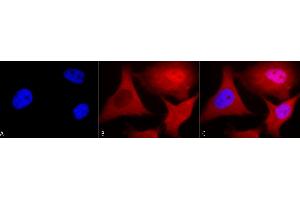 Immunocytochemistry (ICC) image for anti-Ubiquitin (Ub) antibody (ABIN361817)