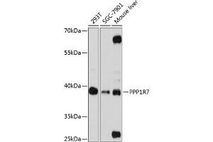 Western blot analysis of extracts of various cell lines, using PPP1R7 antibody (ABIN6132827, ABIN6146072, ABIN6146074 and ABIN6216881) at 1:3000 dilution. (PPP1R7 Antikörper  (AA 281-360))