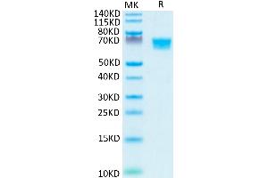 SDS-PAGE (SDS) image for AXL Receptor tyrosine Kinase (AXL) (AA 26-449) protein (His-Avi Tag) (ABIN7273884)