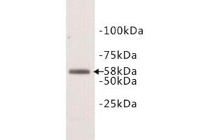 Western Blotting (WB) image for anti-Deoxynucleotidyltransferase, terminal (DNTT) (N-Term) antibody (ABIN1854984) (TdT Antikörper  (N-Term))