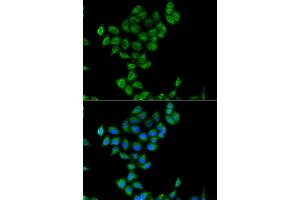 Immunofluorescence analysis of  cells using COQ3 antibody (ABIN6133353, ABIN6138894, ABIN6138895 and ABIN6223356). (COQ3 Antikörper  (AA 50-369))