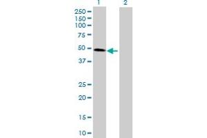 Western Blot analysis of CDC123 expression in transfected 293T cell line by CDC123 MaxPab polyclonal antibody. (CDC123 Antikörper  (AA 1-336))