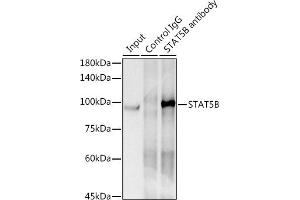 Immunoprecipitation analysis of 300 μg extracts of HeLa cells using 3 μg STB antibody (ABIN7270311). (STAT5B Antikörper)