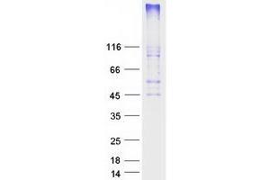 Hydroxycarboxylic Acid Receptor 2 (HCAR2) protein (Myc-DYKDDDDK Tag)