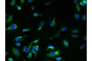 Immunofluorescent analysis of U251 cells using ABIN7173253 at dilution of 1:100 and Alexa Fluor 488-congugated AffiniPure Goat Anti-Rabbit IgG(H+L) (TMEM61 Antikörper  (AA 90-210))