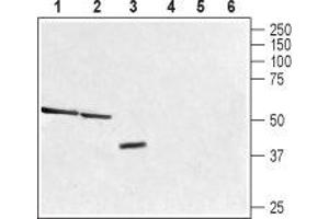 Western blot analysis of rat liver (lane 1 and 4), mouse kidney (lanes 2 and 5) and human brain glioblastoma (U-87) cell (lanes 3 and 6) lysates: - 1-3. (TAAR1 Antikörper  (C-Term, Intracellular))