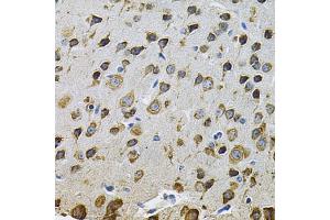 Immunohistochemistry of paraffin-embedded rat brain using NCF4 Antibody (ABIN5971122) at dilution of 1/100 (40x lens). (NCF4 Antikörper)