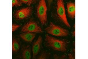 IF analysis of SMC4 using anti-SMC4 antibody (ABIN7602662) and anti-Tubulin Alpha antibody (ABIN7600339). (SMC4 Antikörper  (AA 911-1288))