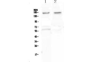 Western blot analysis of Neurexin 1 using anti-Neurexin 1 antibody .