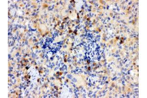 Immunohistochemistry (IHC) image for anti-Toll-Like Receptor 7 (TLR7) (AA 1020-1047), (C-Term) antibody (ABIN3043948)