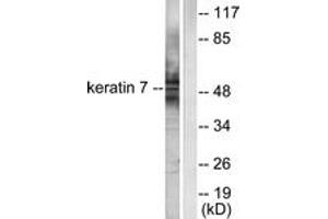 Western blot analysis of extracts from HepG2 cells, using Keratin 7 Antibody.