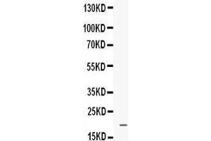 Western blot analysis of Prokineticin 1 expression in MCF-7 whole cell lysates (lane 1). (Prokineticin 1 Antikörper  (AA 20-105))