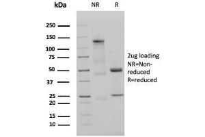 SDS-PAGE Analysis Purified IgM Recombinant Rabbit Monoclonal Antibody (IGHM/3135R). (Rekombinanter IGHM Antikörper)