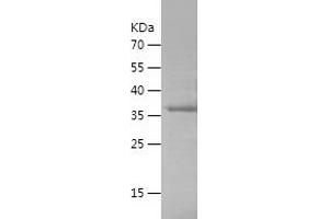Western Blotting (WB) image for Sema Domain, Immunoglobulin Domain (Ig), Transmembrane Domain (TM) and Short Cytoplasmic Domain, (Semaphorin) 4D (SEMA4D) (AA 759-862) protein (His-IF2DI Tag) (ABIN7125019) (SEMA4D/CD100 Protein (AA 759-862) (His-IF2DI Tag))