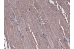 DAB staining on IHC-P; Samples: Mouse Skeletal muscle Tissue (NT5C Antikörper  (AA 12-200))