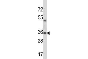ERCC1 antibody western blot analysis in mouse lung tissue lysate (ERCC1 Antikörper  (AA 268-297))