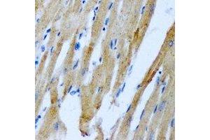 Immunohistochemical analysis of RRM2 staining in rat heart formalin fixed paraffin embedded tissue section. (RRM2 Antikörper)