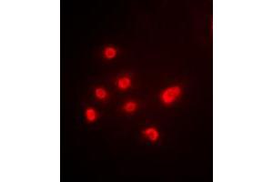 Immunofluorescent analysis of TBP staining in HEK293T cells.