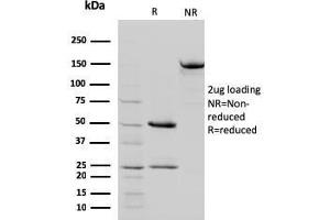 SDS-PAGE Analysis Purified STAT5B Mouse Monoclonal Antibody (STAT5B/2657). (STAT5B Antikörper)