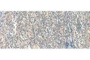 Immunohistochemistry of paraffin-embedded Human tonsil tissue using HASPIN Polyclonal Antibody at dilution of 1:45(x200) (GSG2 Antikörper)