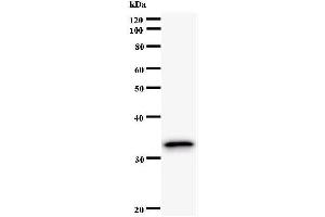 Western Blotting (WB) image for anti-PAP Associated Domain Containing 7 (PAPD7) antibody (ABIN931070)