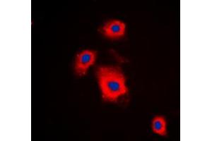 Immunofluorescent analysis of S6K1 (pS447) staining in A549 cells. (RPS6KB1 Antikörper  (C-Term, pSer447))