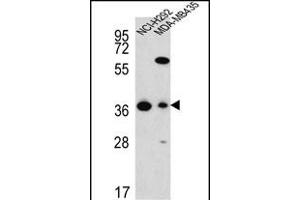 FAHD2A Antibody (C-term) (ABIN652133 and ABIN2840559) western blot analysis in NCI-,MDA-M cell line lysates (35 μg/lane). (FAHD2A Antikörper  (C-Term))