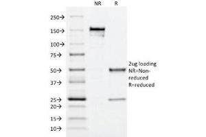 SDS-PAGE Analysis of Purified, BSA-Free MRP1 Antibody (clone MRP1/1344). (ABCC1 Antikörper)