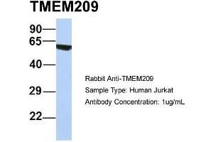 Host: Rabbit Target Name: TMEM209 Sample Type: Human Jurkat Antibody Dilution: 1. (TMEM209 Antikörper  (N-Term))