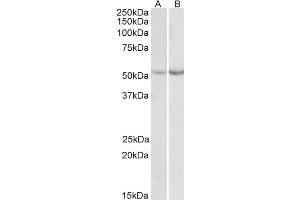 ABIN571236 (0. (Phenylalanine Hydroxylase Antikörper  (Internal Region))