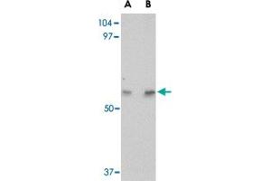 Western blot analysis of LGI4 in human brain tissue lysate with LGI4 polyclonal antibody  at (A) 1 and (B) 2 ug/mL .