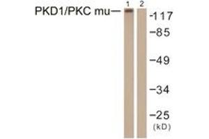 Western blot analysis of extracts from HepG2 cells, using PKD1/PKC mu (Ab-463) Antibody. (PKC mu Antikörper  (AA 429-478))