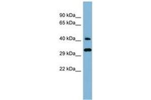Image no. 1 for anti-DnaJ (Hsp40) Homolog, Subfamily C, Member 27 (DNAJC27) (AA 143-192) antibody (ABIN6741773) (DNAJC27 Antikörper  (AA 143-192))
