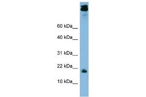 WB Suggested Anti-ASAH1 Antibody Titration: 0. (ASAH1 Antikörper  (Middle Region))