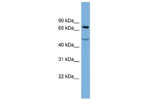 WB Suggested Anti-STIM1  Antibody Titration: 0. (STIM1 Antikörper  (Middle Region))