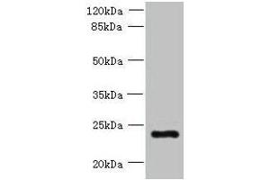 Western blot All lanes: PQLC3 antibody at 3 μg/mL + Mouse liver tissue Secondary Goat polyclonal to rabbit IgG at 1/10000 dilution Predicted band size: 23, 21 kDa Observed band size: 23 kDa (PQLC3 Antikörper  (AA 118-170))